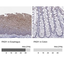 PADI1 Antibody, Novus Biologicals 25 &mu;L:Antibodies, Polyclonal
